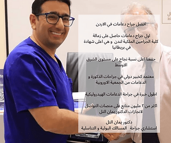 أفضل أنواع دعامة الانتصاب