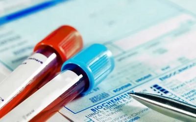 The best laboratory tests to maintain men’s health in Dubai