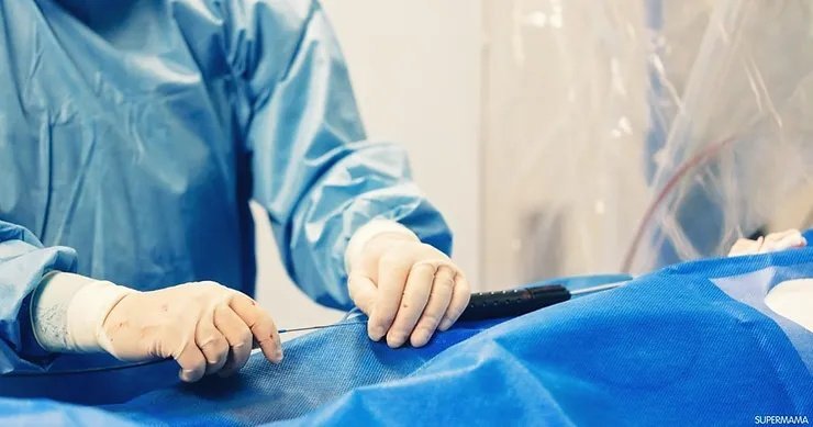 إزالة دعامة الحالب