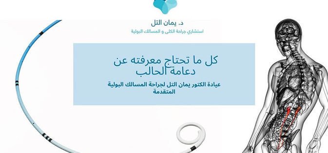 دعامة-الحالب.jpg