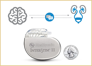 بطارية تنظيم المثانة العصبية