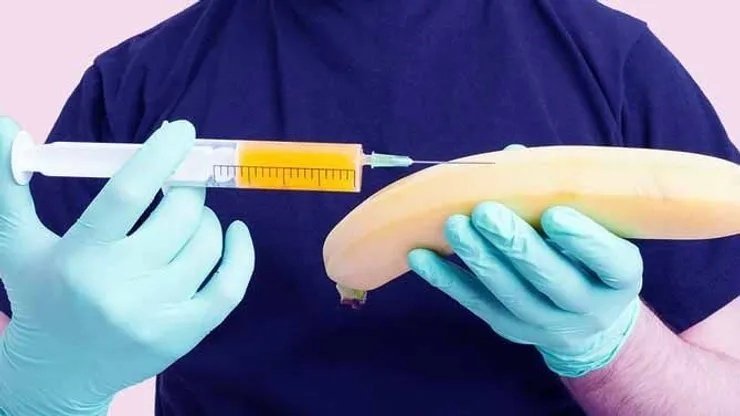 حقن فيلر للقضيب