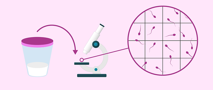 تورم السائل المنوي