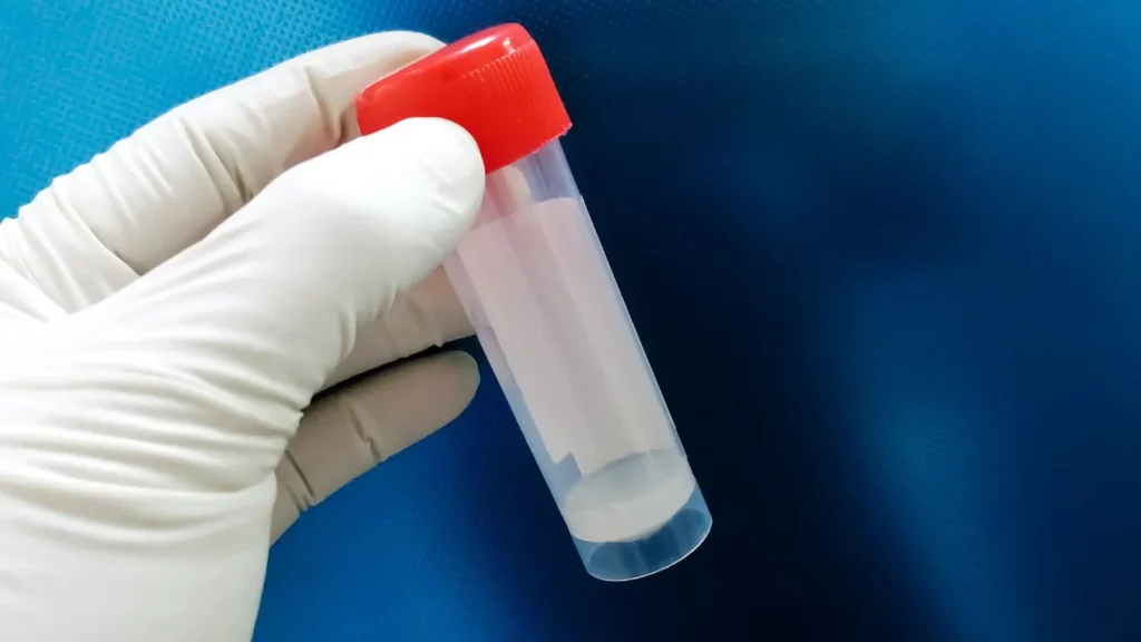 شكل السائل المنوي