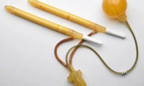 ما هي مضاعفات تركيب دعامة الذكر؟