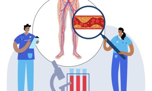 دوالي الخصية