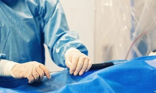 إزالة دعامة الحالب