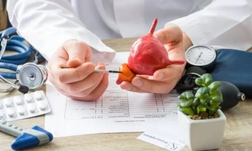 عملية البروستات بالليزر