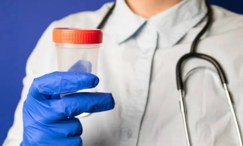 انعدام الحيوانات المنوية