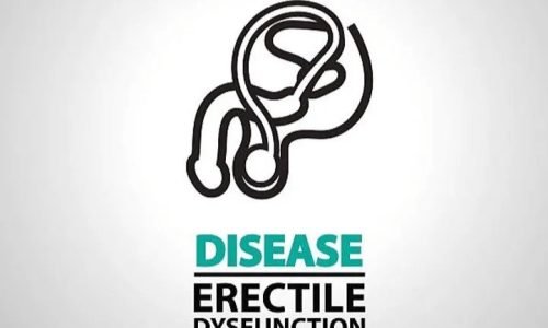 عملية دعامة الانتصاب الهيدروليكية خطوة بخطوة