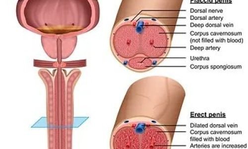 كل ما يجب معرفته عن تكلفة دعامة القضيب واستعمالاتها 2023