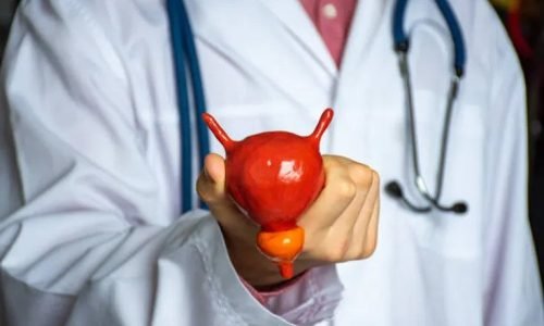 rezum علاج البروستات بالبخار