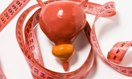 تهبطية المثانة