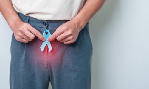 تفتيت الحصى