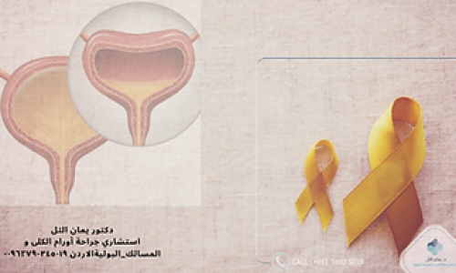 كل ما تحتاج معرفته عن سرطان المثانة