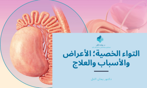 التواء الخصية التواء الخصية؛ الأعراض والأسباب والعلاج