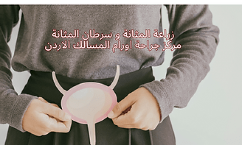 زراعة المثانة: كل ما تحتاج إلى معرفته عن العملية الجراحية وعملية التعافي