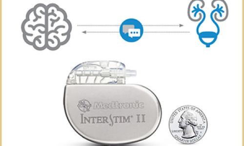 بطارية تنظيم المثانة العصبية