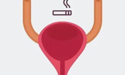 سرطان المثانة