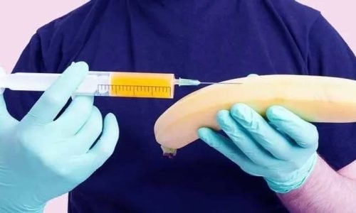 حقن فيلر للقضيب