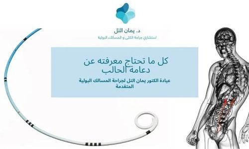 دعامة الحالب و اعراضه و ازالتها