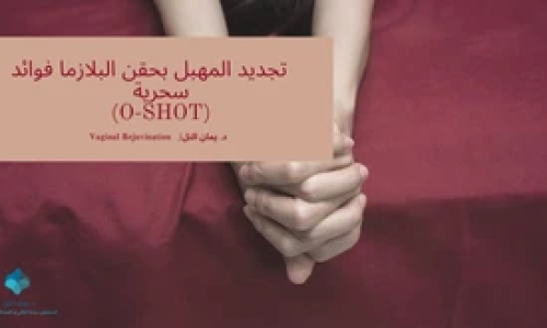 ال أوشوت حقن البلازما للمهبل O SHOT