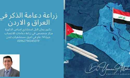 زراعة دعامات الذكر في العراق ميزة الاردن في علاج الضعف الجنسي