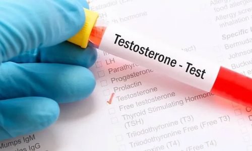 testosterone - test