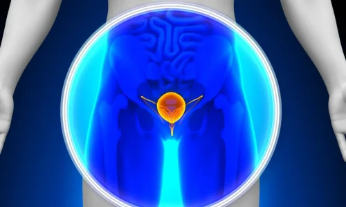 سرطان المثانة