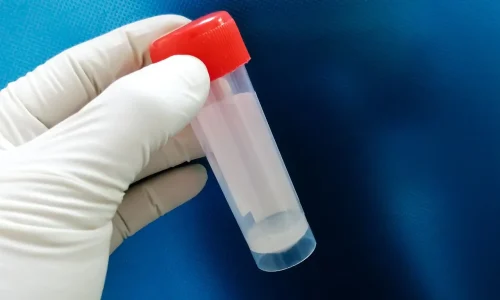 شكل السائل المنوي